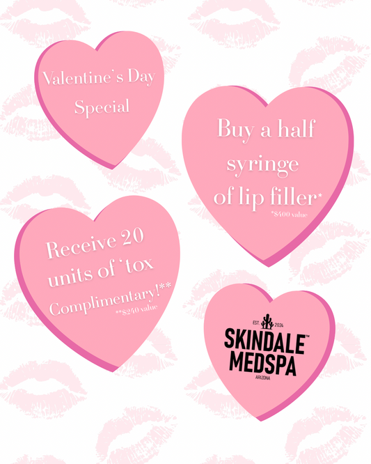 Skindale Valentine's Day Special