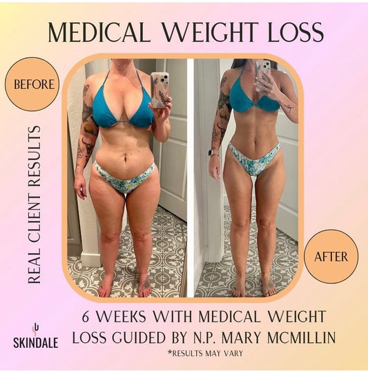 Skindale FIT Weight loss Program